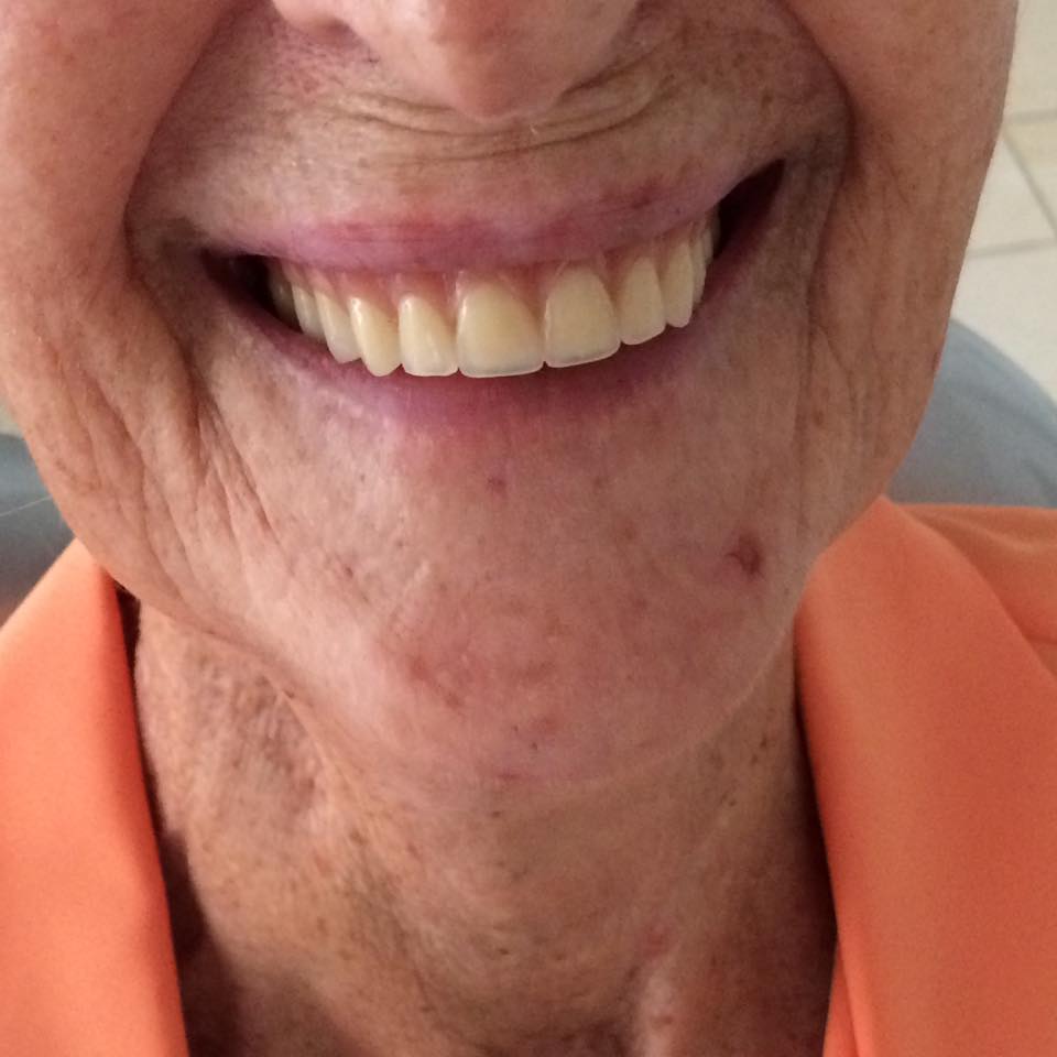 dental implant testimonies