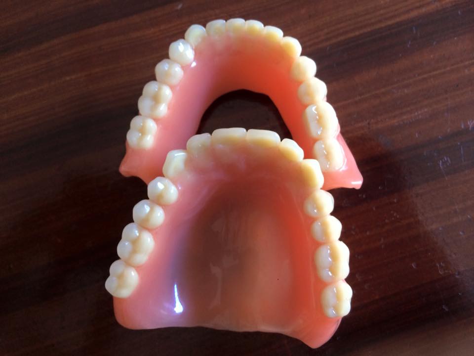 dental implant case